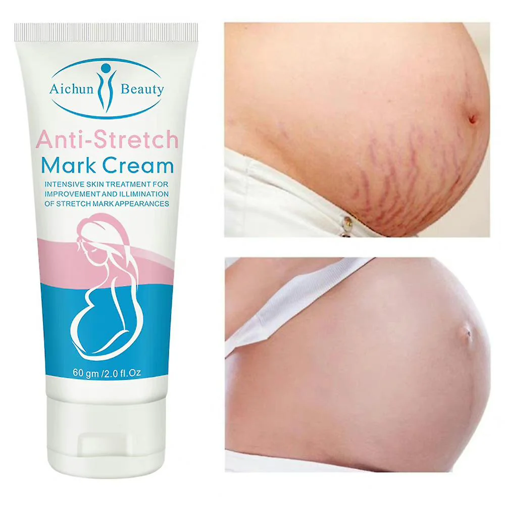 Aichun beauty Anti-Stretch Mark Cream 60g - Image 2