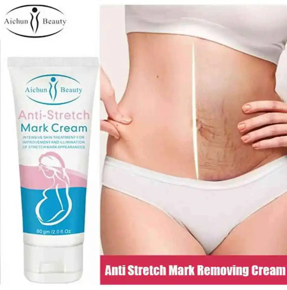 Aichun beauty Anti-Stretch Mark Cream 60g - Image 4